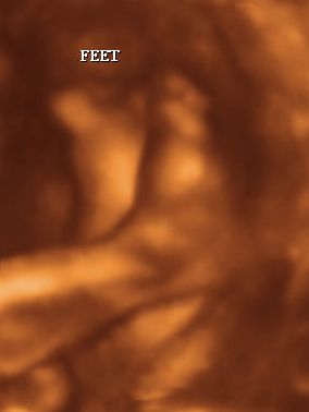 3d baby feet ultrasound
