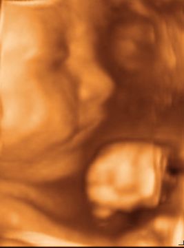3d baby face ultrasound