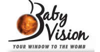baby vision 4d atlanta, georgia