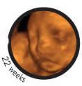 Baby Vision 4D Ultrasound - Atlanta, Georgia